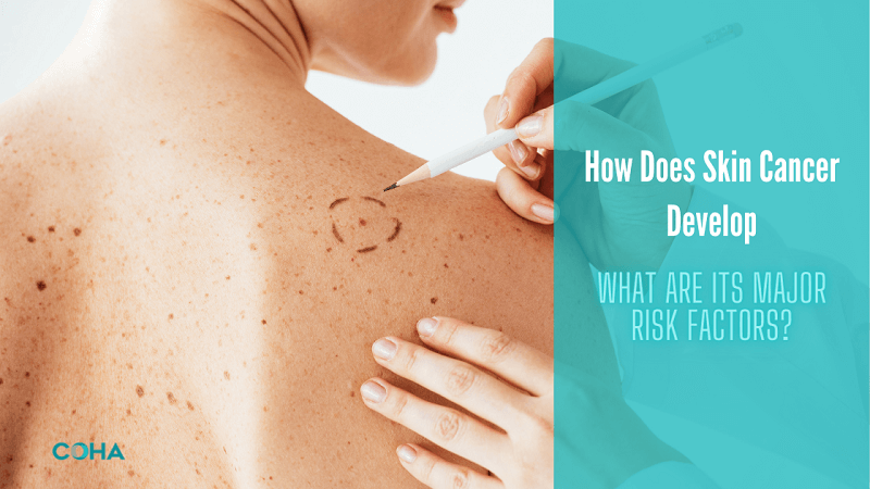 How Does Skin Cancer Develop and What Are Its Major Risk Factors?