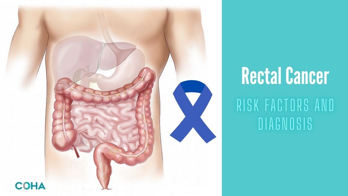 Rectal Cancer: Risk Factors and Diagnosis